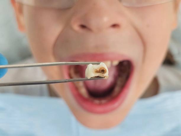 Best Emergency Dentist for Kids  in Williston Park, NY